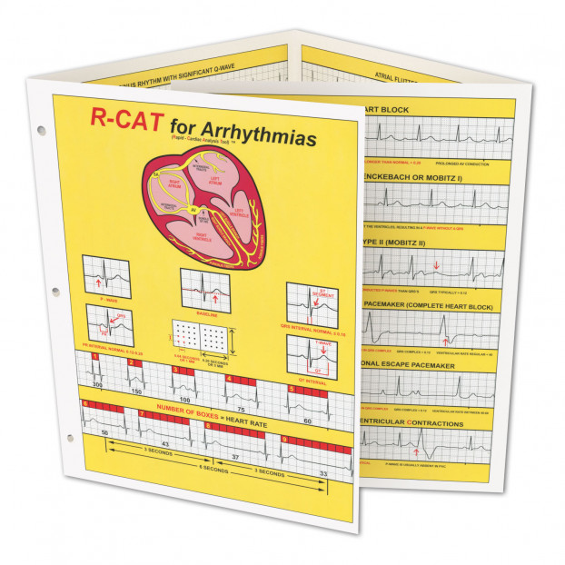 R-CAT for Arrhythmias